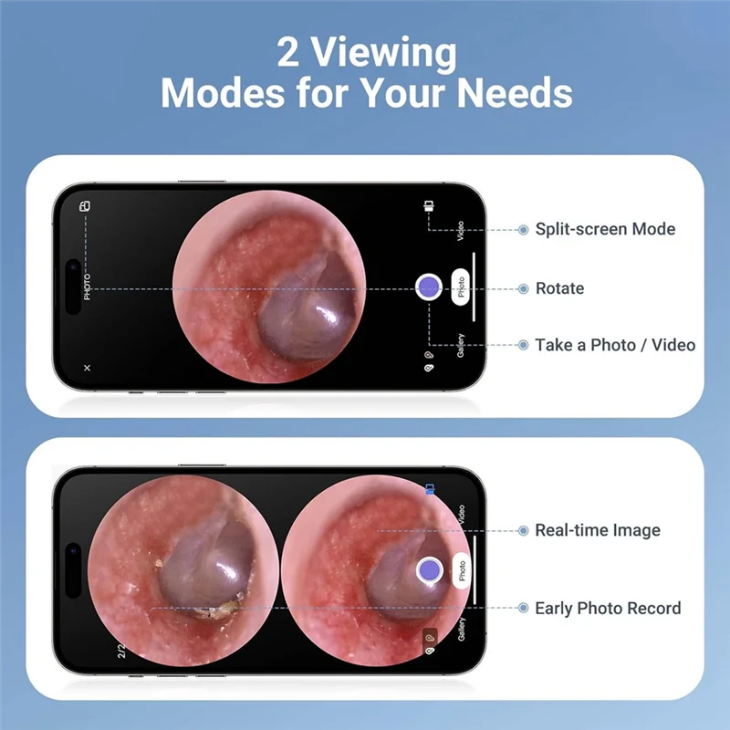 FORW-Digital Otoscope With Light, 1.85 In IPS Screen, 720P HD Video Ear Camera, Ear Wax Removal Tool