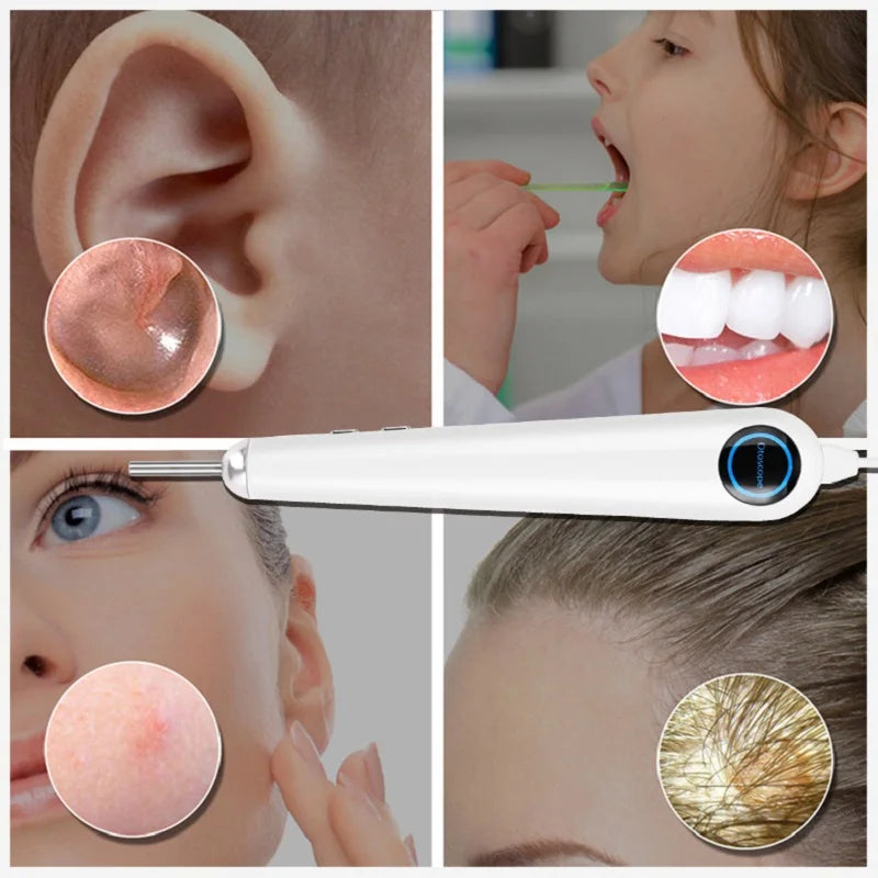 3.2mm Lens Digital Otoscope with 1080P HD 10.1 Inches Screen Ear Scope ENT Endoscope Ear Cleaner Tools 3500mAh Battery