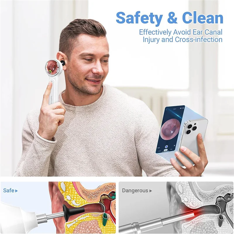 FORW-Digital Otoscope With Light, 1.85 In IPS Screen, 720P HD Video Ear Camera, Ear Wax Removal Tool