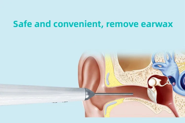 3.2mm Lens Digital Otoscope with 1080P HD 10.1 Inches Screen Ear Scope ENT Endoscope Ear Cleaner Tools 3500mAh Battery