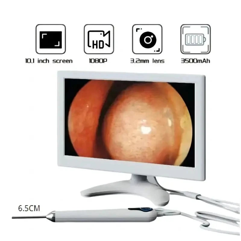 3.2mm Lens Digital Otoscope with 1080P HD 10.1 Inches Screen Ear Scope ENT Endoscope Ear Cleaner Tools 3500mAh Battery