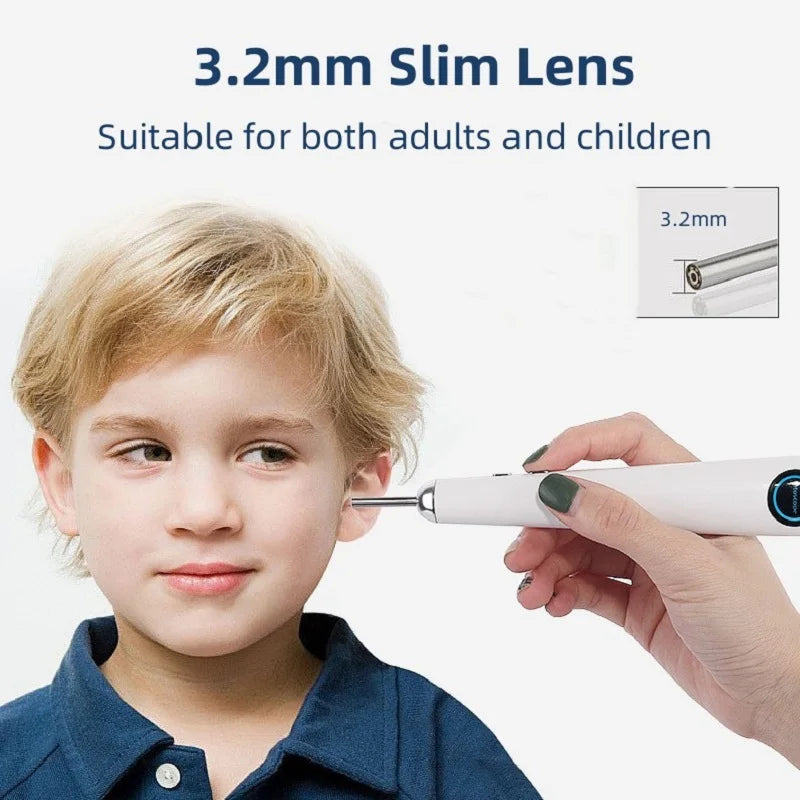 3.2mm Lens Digital Otoscope with 1080P HD 10.1 Inches Screen Ear Scope ENT Endoscope Ear Cleaner Tools 3500mAh Battery